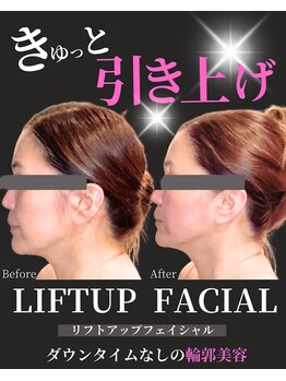 ノーブルノアール(Noble noir)/きゅっと引き上げ小顔へ