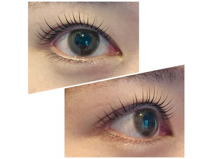 ミユハル(Miyu☆Halu)の写真