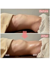 メデル(MEDEL)/大人気♪腸もみメニュー