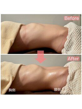 メデル(MEDEL)/大人気♪腸もみメニュー