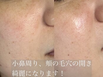 ベルード(veludo)/