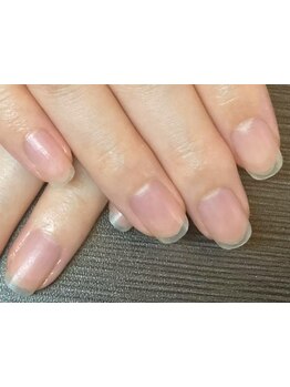 爪の悩みを解消できる（ケア含む）