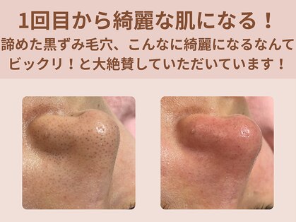 ミキティ(MIKITY)の写真