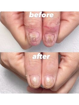 ナチュラドール(NATURADORm)/人気の自爪育成★