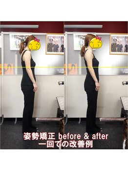 ワイルドボディ(WILD BODY)/姿勢矯正での改善例