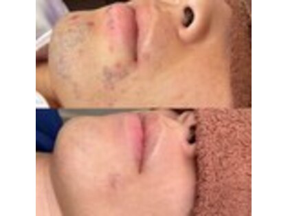 プルメリア(Plumeria)の写真