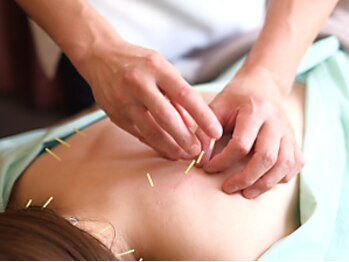 かわい指圧ルームの写真/鍼灸初心者の方でも安心！ソフトで細い鍼を用いて施術し、刺激に敏感な方でも更なる効果を実感できます！