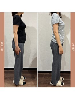 和ぎ整体院/姿勢が改善、ぽっこりお腹改善