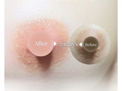 【黒ずみケア専門店】more.メラニンケア/フェムケアの写真