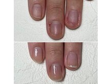 アンスリール(un sourire)の雰囲気（３ヶ月で変わる美爪育成プログラム◎）