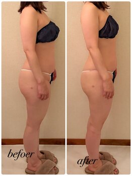 シャルマン(Charmant)/全身バストbefoer.after