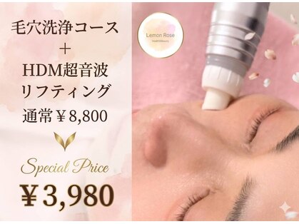 レモンローズ(Lemon Rose)の写真