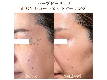 アルッカ(Arukka)の写真