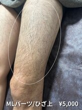 カナウ(KANAU)/【LLパーツ/脱毛】ひざ上