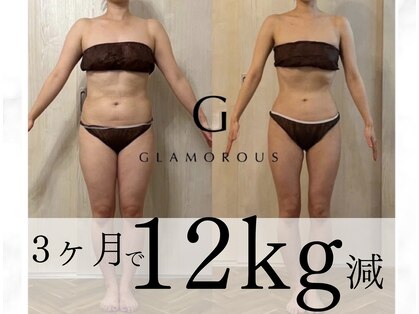 アーベル(Ar-Belle)の写真