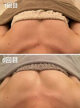 美人バスト 岡崎店/【バストアップ★育乳】症例