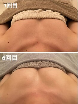 美人バスト 岡崎店/【バストアップ★育乳】症例