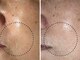 ソワンプラス(soin+)の写真/乾燥からくる小ジワ・ほうれい線は早めにケアを！