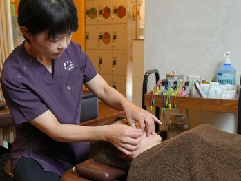スマイル鍼灸整骨院 北九州不妊鍼灸たまご堂の写真/《美容鍼》女性鍼灸師が施術をおこないます。美容鍼や顔や頭のマッサージで理想の自分を目指そう◎