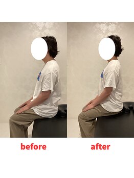 ナオル整体 福岡香椎院(NAORU整体)/30代男性施術事例【猫背】
