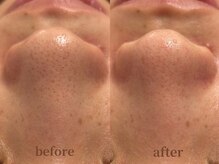 サロン エム(saron M)/お客様ビフォーアフター