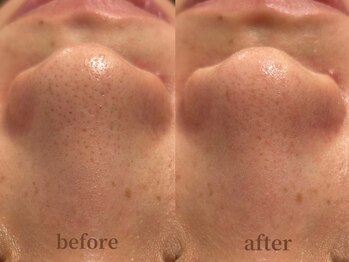 サロン エム(saron M)/お客様ビフォーアフター