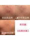 ベレディオ鍼灸整骨院(Belledio鍼灸整骨院)の写真/肌が変わる。印象が変わる。美容鍼で叶う“素肌美”の新習慣★ほうれい線やたるみ改善!リフトアップにも◎