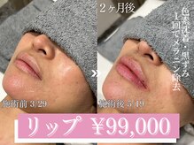 アリウム(ALLIUM)の雰囲気(ローマピンク導入店♪)