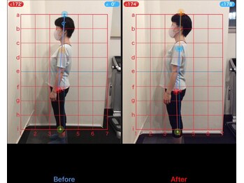 ケアハウス(CARE HOUSE)/施術効果写真☆(before after)