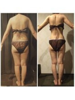 ココラーレ(cocorare)/痩身/日暮里/ダイエット/エステ