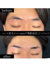 ユー 千葉駅前店(you)/ビフォ－アフター写真