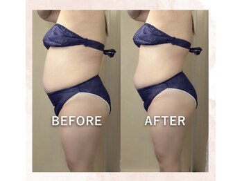 ヒトハナ(hitohana)/6回目!見違えるほど♪スッキリ！