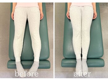 錦糸町北口整体院/産後骨盤矯正×腰痛/BeforeAfter