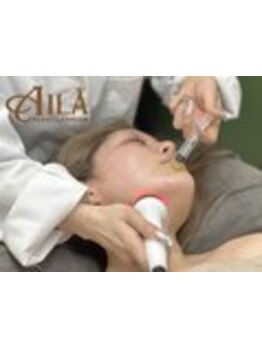 小顔になりたい