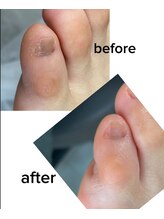 エム 平岸(M)/【副爪（1）】30代女性