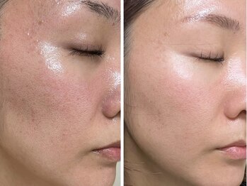 マリヴェリーテ(Mari verite)/化粧の厚塗り、もうやめたい