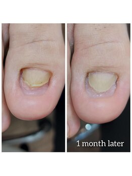 爪切り屋 足楽/