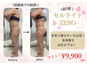 ナチュールファースト(naturel first)の写真/【短期間で変わりたい】1回でも変化実感◎全身スッキリ痩身コース