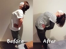 クーオス(KuuOs)/【30代/女性】6回の施術後変化