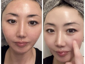 ミルジュ(MiLuJu)/レストセルトリートメント