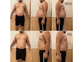 サロン ド レーヴ(Salon de Reve)/【お客様の事例】Billy’s Care