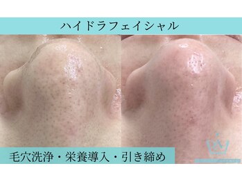 リメイククリニカルビューティー(Remake clinical beauty)/角栓つまってない？