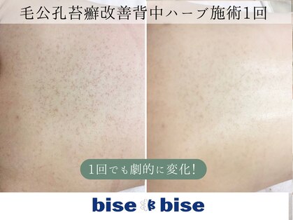 ビズビズ 天王寺店(bisebise)の写真