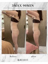 ラズリ(Lazuli)/3max 90min 施術3回