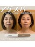 【全身むくみケア！小顔効果で気分も上がる】小顔炭酸ヘッドスパ　¥17060→