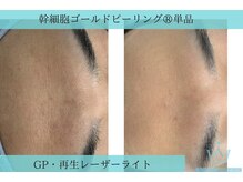 リメイク 広尾(REMAKE)/