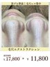 【毛穴にお悩みの方】黒ずみケア毛穴エクストラクション￥17800→11800