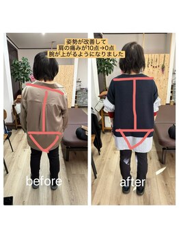 アンティオール 古河店/肩の痛みに！【古河　整体】