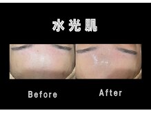 エステティック レイビス 銀座店(RAYVIS)/