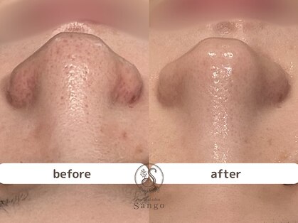 サンゴ(Sango)の写真